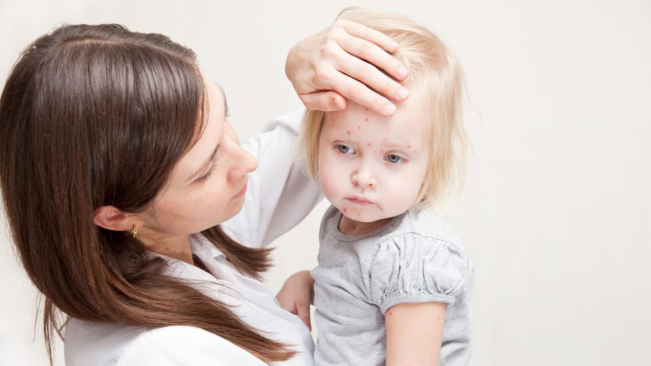 Стрептодермии на голове у ребенка