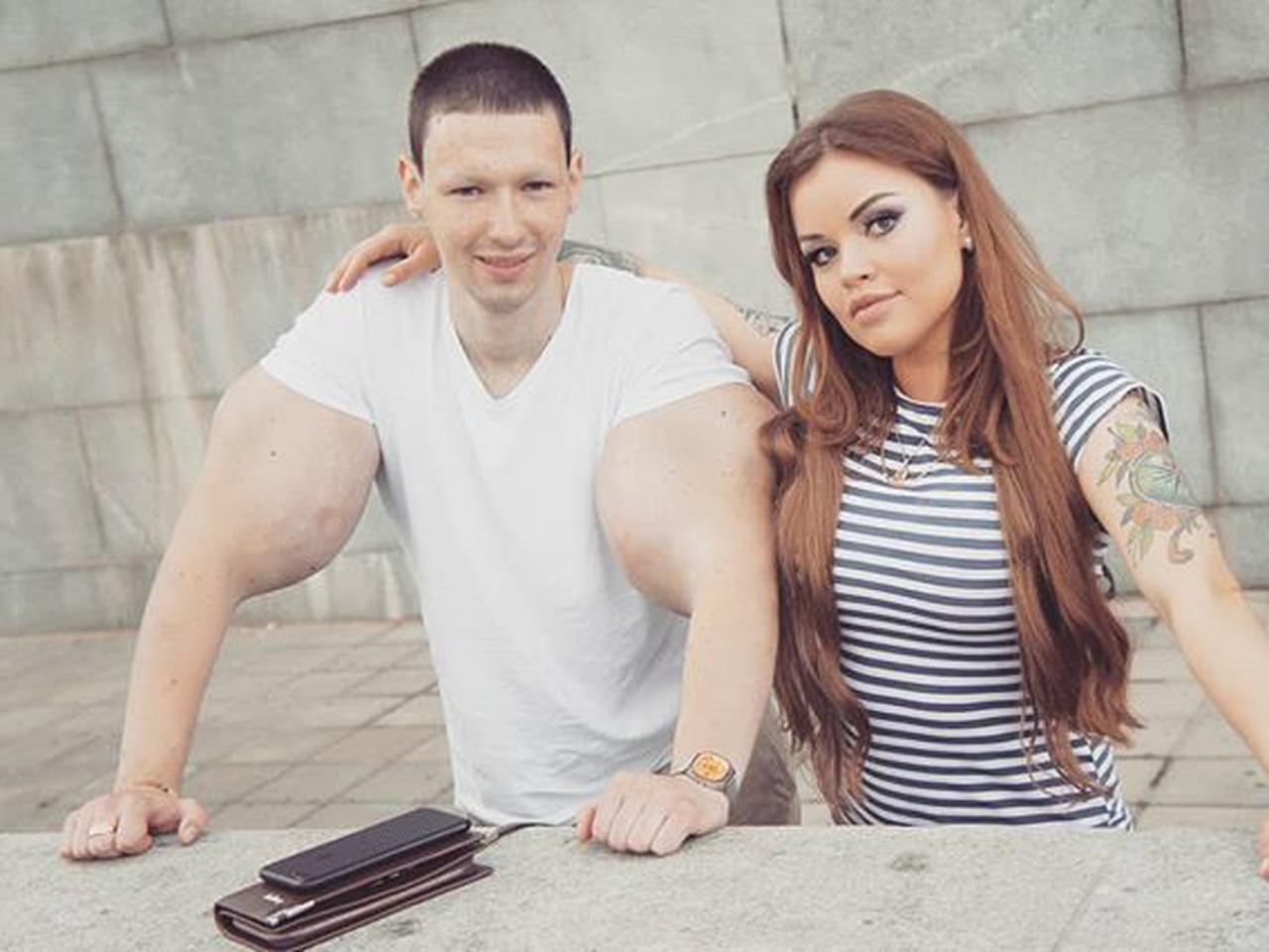 А секс — после ЗАГСа: жертва пластики «Руки-базуки» женится на эротической  модели | WMJ.ru